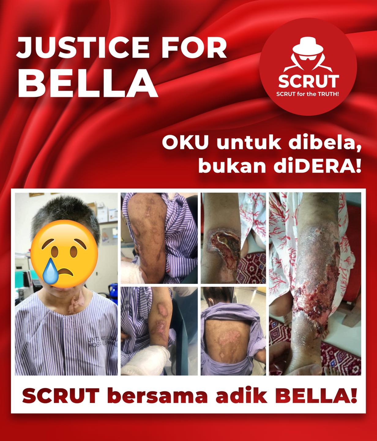 Justice for bella